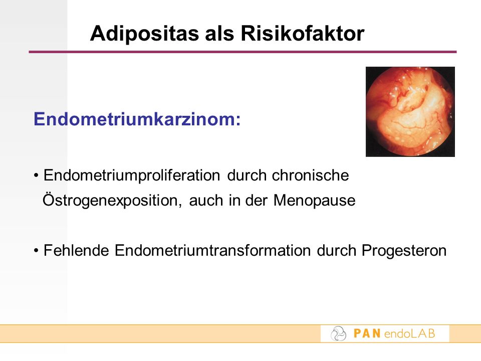 adipositas obesitas verschil adipositas obesitas verschil